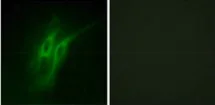 Immunocytochemistry/ Immunofluorescence - Anti-5HT4 Receptor antibody (AB60359)