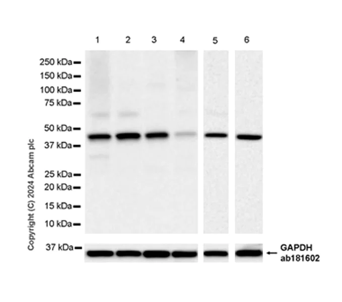 Western blot - Anti-5HT4 Receptor antibody [EPR28675-19] (AB317500)