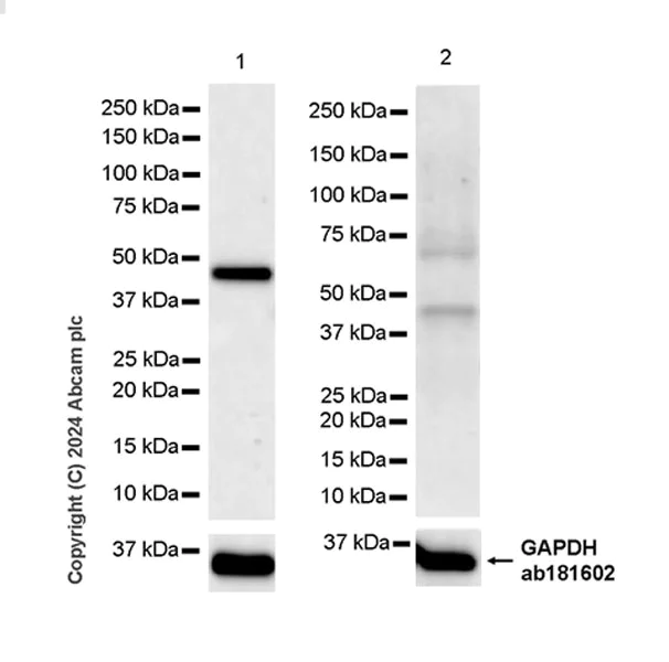 Western blot - Anti-5HT4 Receptor antibody [EPR28675-19] (AB317500)