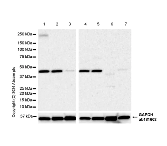 Western blot - Anti-5HT4 Receptor antibody [EPR28675-19] (AB317500)