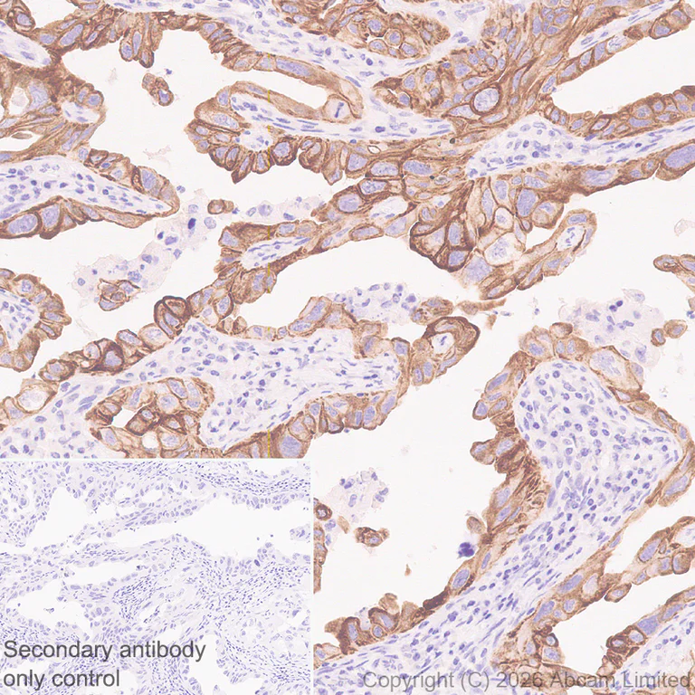 Immunohistochemistry (Formalin/PFA-fixed paraffin-embedded sections) - Anti-5HT4 Receptor antibody [EPR28675-68] (AB327053)