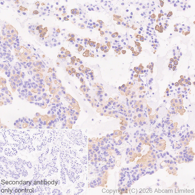 Immunohistochemistry (Formalin/PFA-fixed paraffin-embedded sections) - Anti-5HT4 Receptor antibody [EPR28675-68] (AB327053)