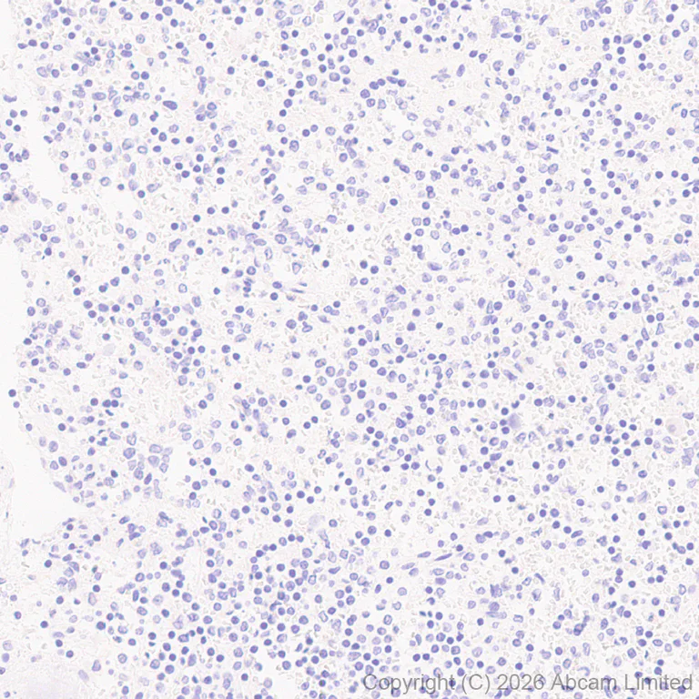 Immunohistochemistry (Formalin/PFA-fixed paraffin-embedded sections) - Anti-5HT4 Receptor antibody [EPR28675-68] (AB327053)