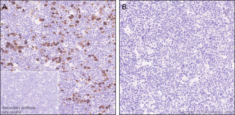 Immunohistochemistry (Formalin/PFA-fixed paraffin-embedded sections) - Anti-5HT4 Receptor antibody [EPR28675-68] (AB327053)