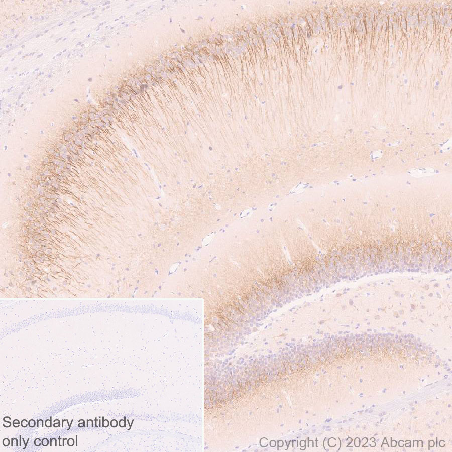 Immunohistochemistry (Formalin/PFA-fixed paraffin-embedded sections) - Anti-5HT6 Receptor antibody [EPR26400-50] (ab315380), expandable thumbnail