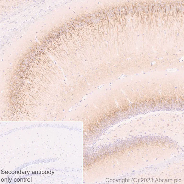 Immunohistochemistry (Formalin/PFA-fixed paraffin-embedded sections) - Anti-5HT6 Receptor antibody [EPR26400-50] (AB315380)