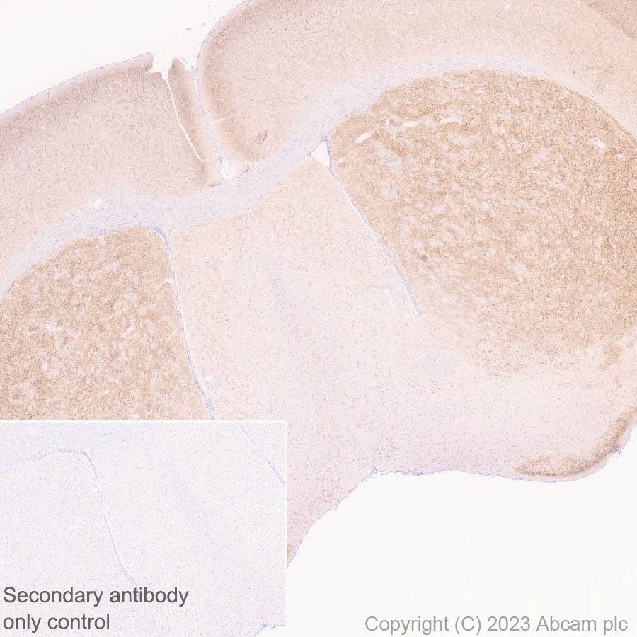 Immunohistochemistry (Formalin/PFA-fixed paraffin-embedded sections) - Anti-5HT6 Receptor antibody [EPR26400-50] (ab315380), expandable thumbnail