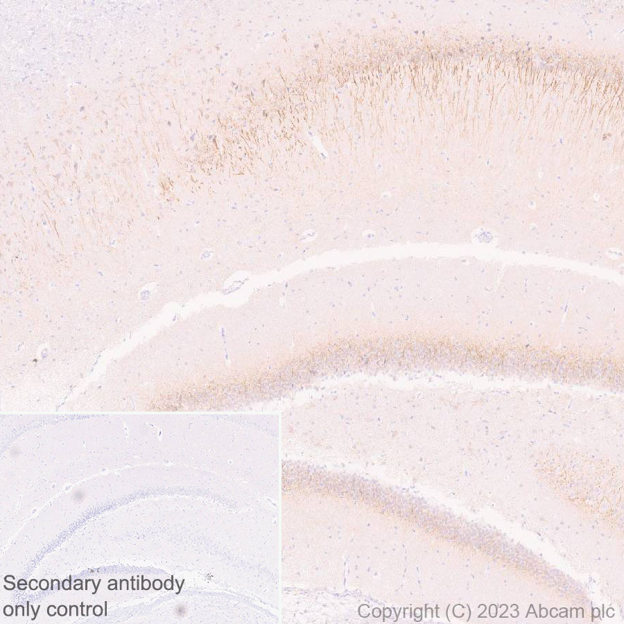 Immunohistochemistry (Formalin/PFA-fixed paraffin-embedded sections) - Anti-5HT6 Receptor antibody [EPR26400-50] (ab315380), expandable thumbnail