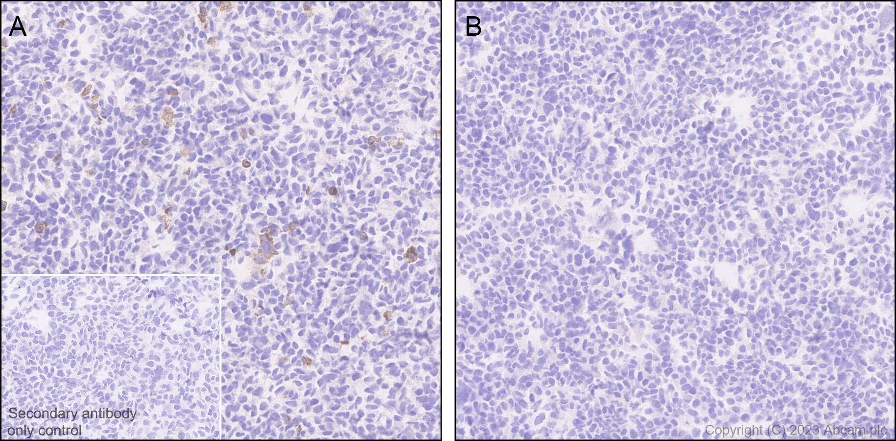 Immunohistochemistry (Formalin/PFA-fixed paraffin-embedded sections) - Anti-5HT6 Receptor antibody [EPR26400-50] (ab315380), expandable thumbnail