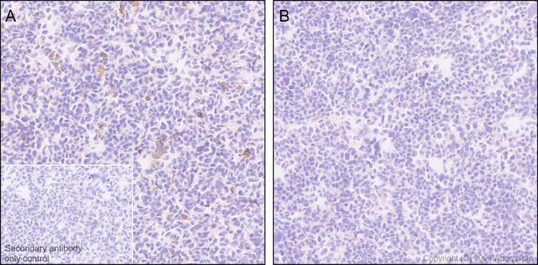 Immunohistochemistry (Formalin/PFA-fixed paraffin-embedded sections) - Anti-5HT6 Receptor antibody [EPR26400-50] (AB315380)