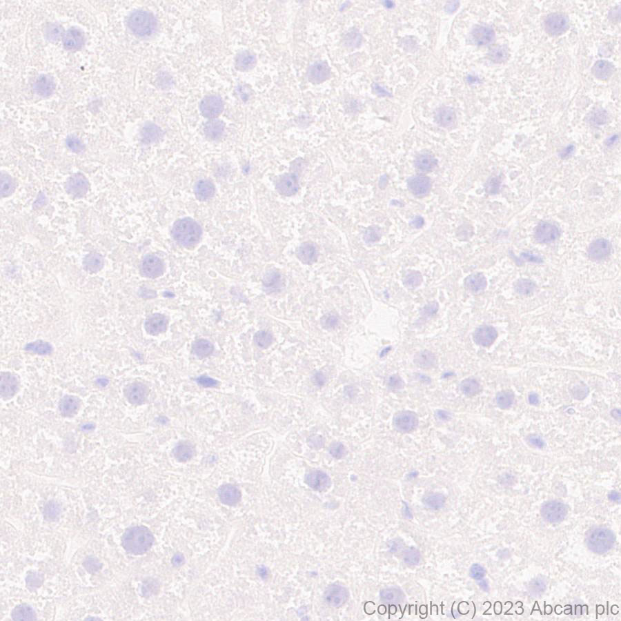 Immunohistochemistry (Formalin/PFA-fixed paraffin-embedded sections) - Anti-5HT6 Receptor antibody [EPR26400-50] (ab315380), expandable thumbnail