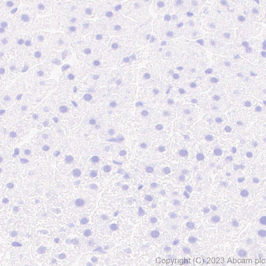 Immunohistochemistry (Formalin/PFA-fixed paraffin-embedded sections) - Anti-5HT6 Receptor antibody [EPR26400-50] (ab315380), expandable thumbnail