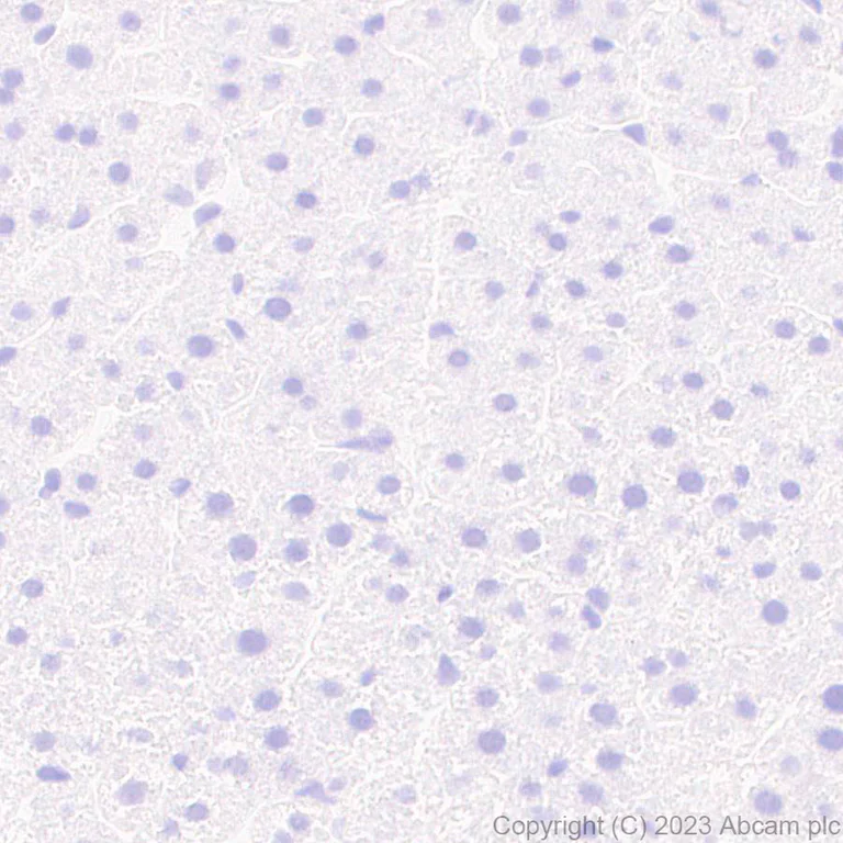 Immunohistochemistry (Formalin/PFA-fixed paraffin-embedded sections) - Anti-5HT6 Receptor antibody [EPR26400-50] (AB315380)