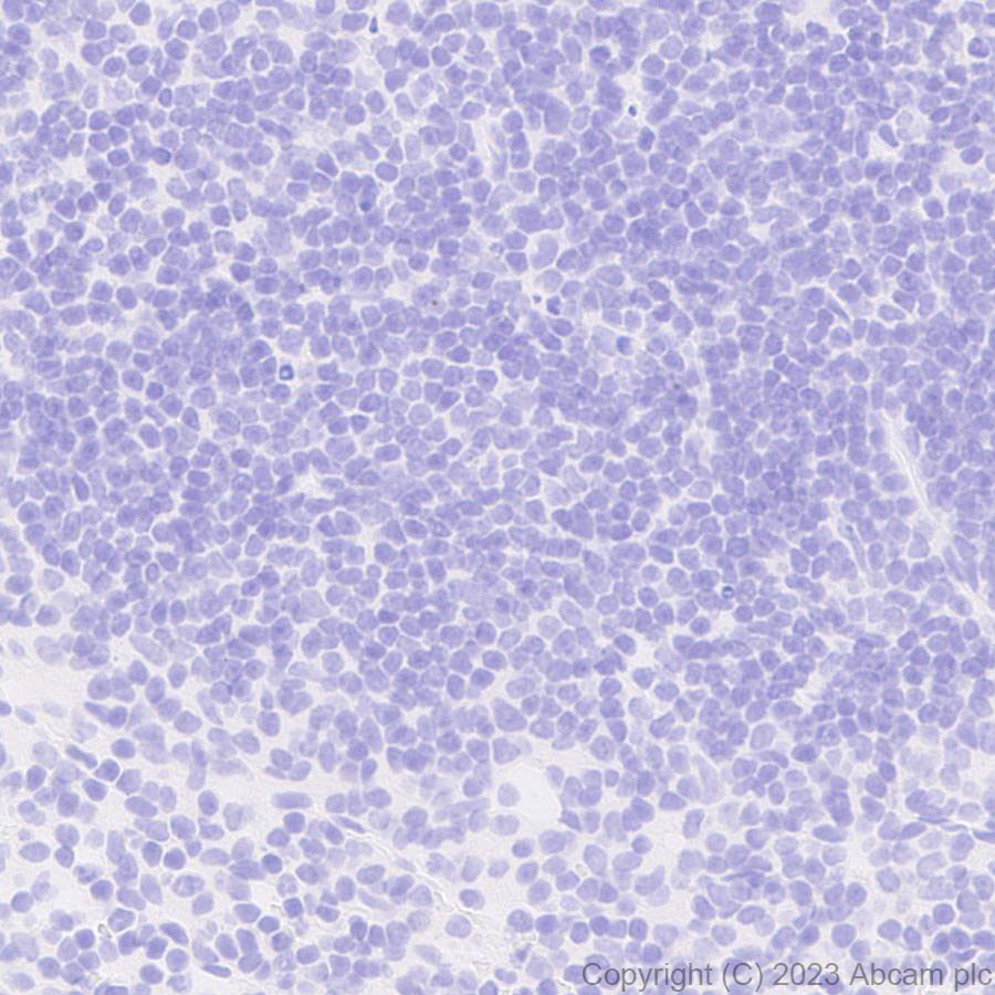 Immunohistochemistry (Formalin/PFA-fixed paraffin-embedded sections) - Anti-5HT6 Receptor antibody [EPR26400-50] (ab315380), expandable thumbnail