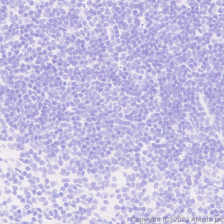 Immunohistochemistry (Formalin/PFA-fixed paraffin-embedded sections) - Anti-5HT6 Receptor antibody [EPR26400-50] (AB315380)