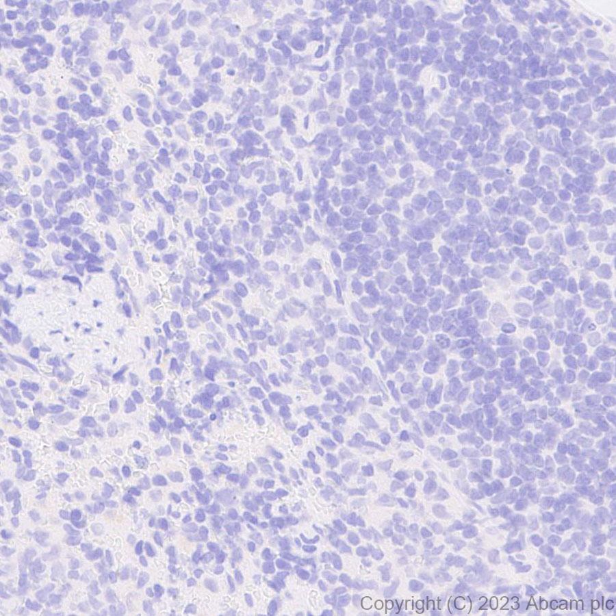 Immunohistochemistry (Formalin/PFA-fixed paraffin-embedded sections) - Anti-5HT6 Receptor antibody [EPR26400-50] (ab315380), expandable thumbnail