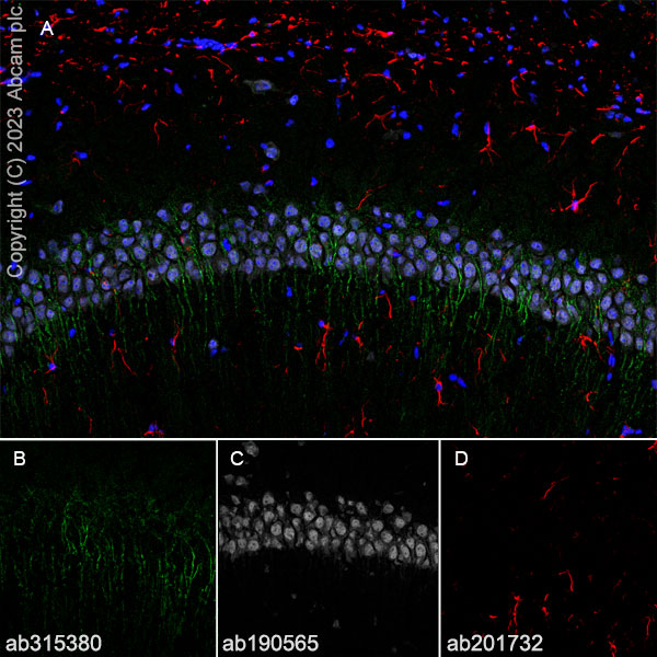 Immunohistochemistry (Frozen sections) - Anti-5HT6 Receptor antibody [EPR26400-50] (AB315380), expandable thumbnail
