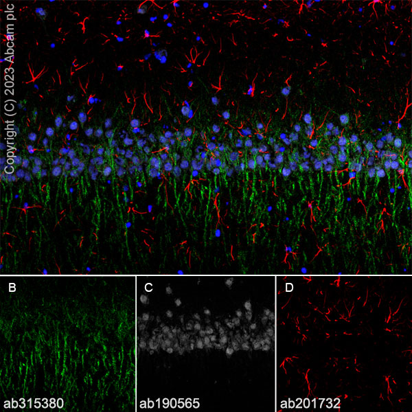 Immunohistochemistry (Frozen sections) - Anti-5HT6 Receptor antibody [EPR26400-50] (AB315380), expandable thumbnail