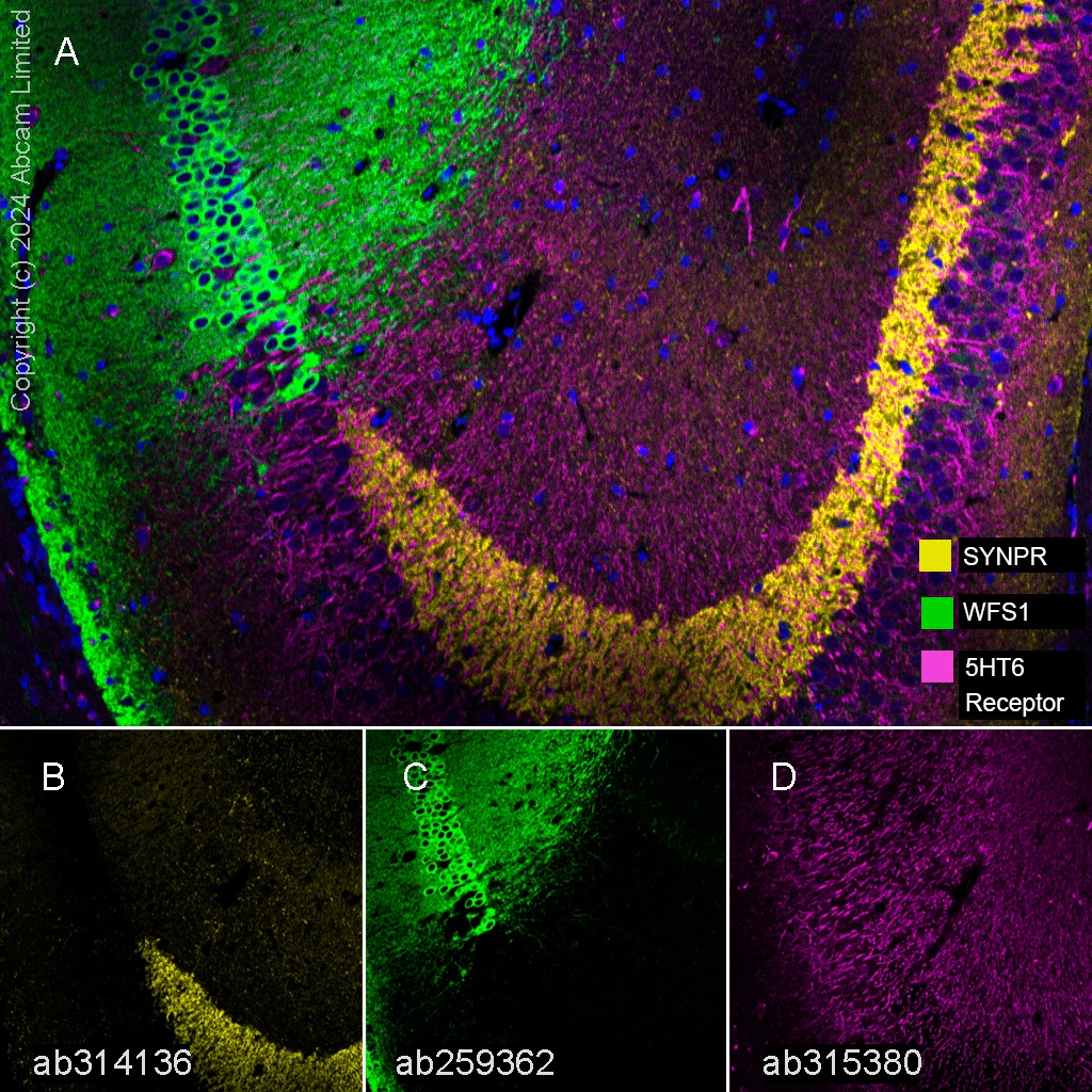 Multiplex immunohistochemistry - Anti-5HT6 Receptor antibody [EPR26400-50] (AB315380), expandable thumbnail