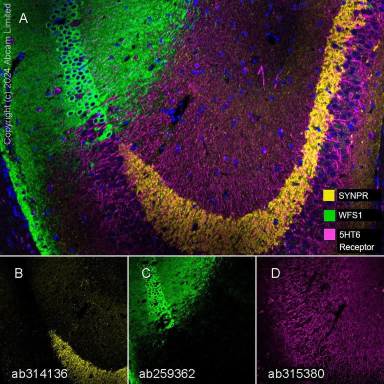 Multiplex immunohistochemistry - Anti-5HT6 Receptor antibody [EPR26400-50] (AB315380)