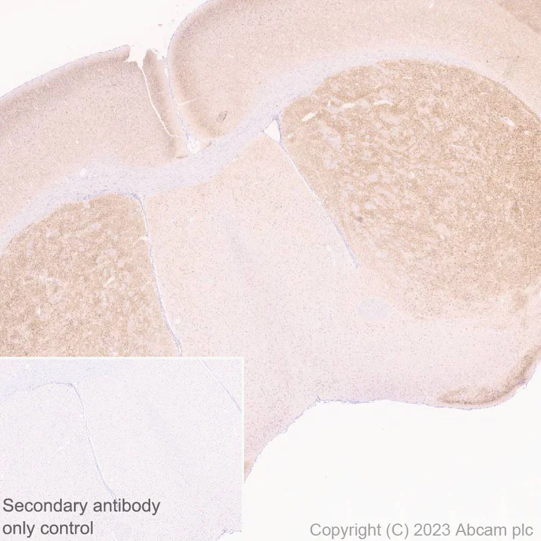 Immunohistochemistry (Formalin/PFA-fixed paraffin-embedded sections) - Anti-5HT6 Receptor antibody [EPR26400-50] - BSA and Azide free (AB315381)