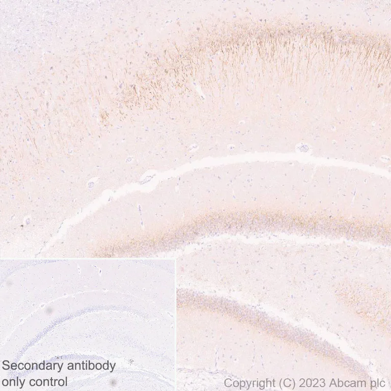 Immunohistochemistry (Formalin/PFA-fixed paraffin-embedded sections) - Anti-5HT6 Receptor antibody [EPR26400-50] - BSA and Azide free (AB315381)