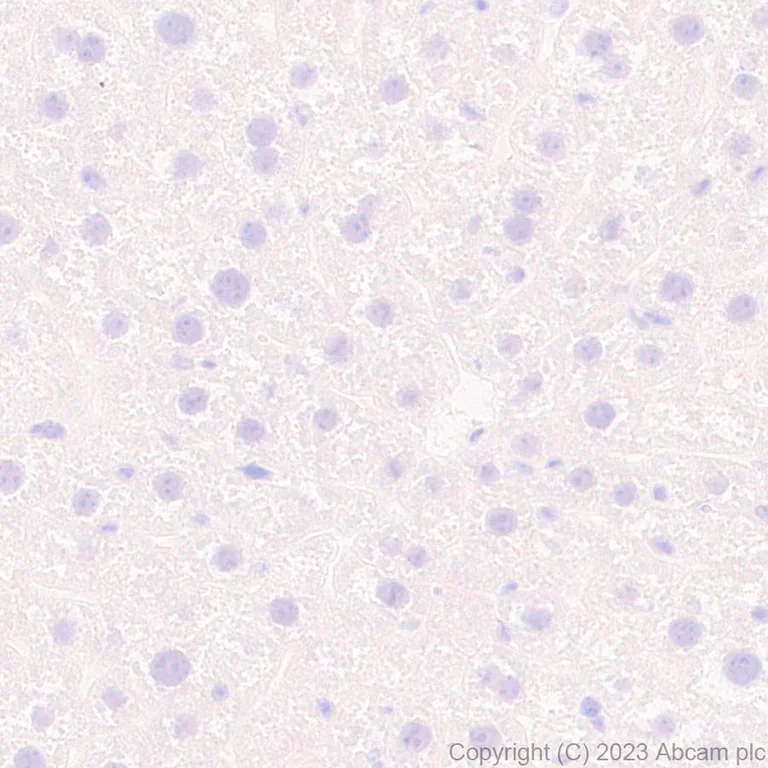 Immunohistochemistry (Formalin/PFA-fixed paraffin-embedded sections) - Anti-5HT6 Receptor antibody [EPR26400-50] - BSA and Azide free (AB315381)