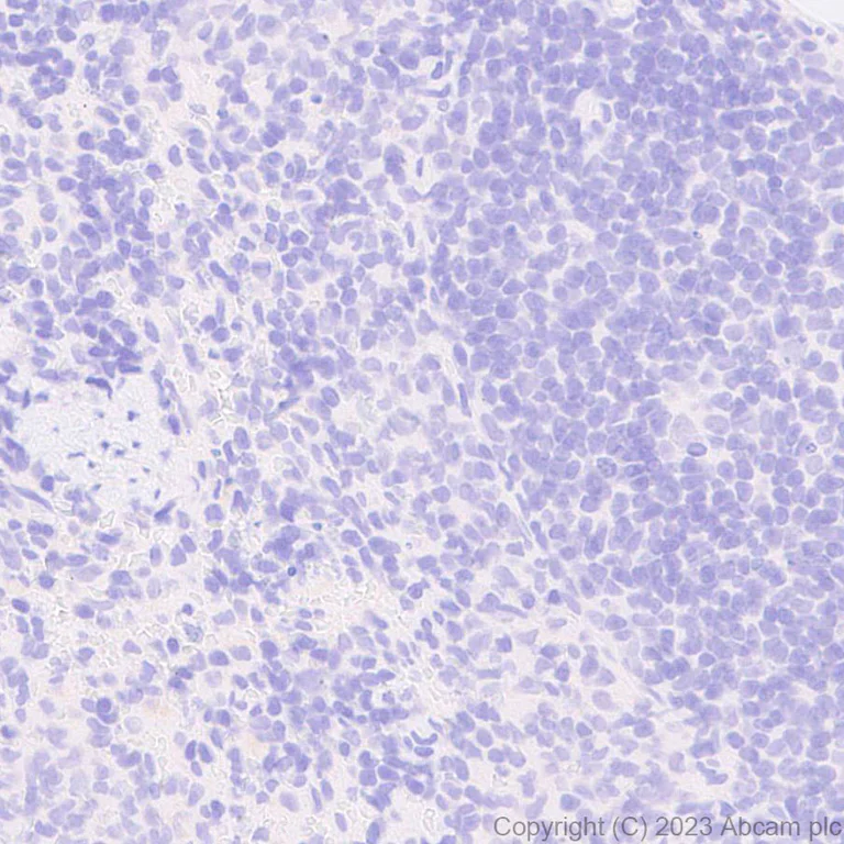 Immunohistochemistry (Formalin/PFA-fixed paraffin-embedded sections) - Anti-5HT6 Receptor antibody [EPR26400-50] - BSA and Azide free (AB315381)