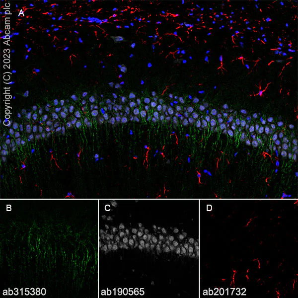 Immunohistochemistry (Frozen sections) - Anti-5HT6 Receptor antibody [EPR26400-50] - BSA and Azide free (AB315381)