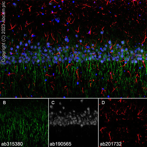 Immunohistochemistry (Frozen sections) - Anti-5HT6 Receptor antibody [EPR26400-50] - BSA and Azide free (AB315381)