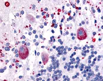 Immunohistochemistry (Formalin/PFA-fixed paraffin-embedded sections) - Anti-5HT7 Receptor antibody (AB61823), expandable thumbnail