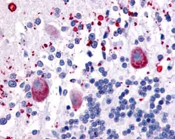 Immunohistochemistry (Formalin/PFA-fixed paraffin-embedded sections) - Anti-5HT7 Receptor antibody (AB61823)