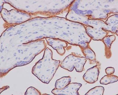 Immunohistochemistry (Formalin/PFA-fixed paraffin-embedded sections) - Anti-5T4 antibody [EPR5529] (ab134162), expandable thumbnail