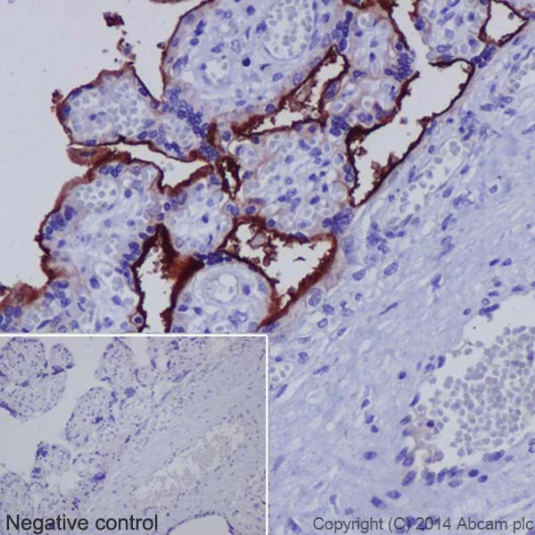 Immunohistochemistry (Formalin/PFA-fixed paraffin-embedded sections) - Anti-5T4 antibody [EPR5529] (AB134162)