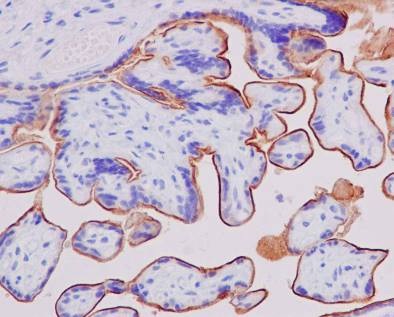 Immunohistochemistry (Formalin/PFA-fixed paraffin-embedded sections) - Anti-5T4 antibody [EPR5529] (ab134162), expandable thumbnail
