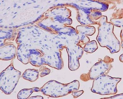 Immunohistochemistry (Formalin/PFA-fixed paraffin-embedded sections) - Anti-5T4 antibody [EPR5529] (AB134162)
