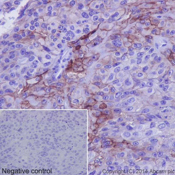Immunohistochemistry (Formalin/PFA-fixed paraffin-embedded sections) - Anti-5T4 antibody [EPR5529] (AB134162)