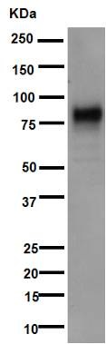 Western blot - Anti-5T4 antibody [EPR5529] (AB134162), expandable thumbnail