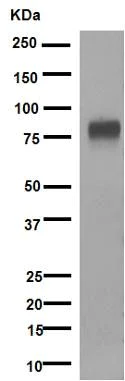 Western blot - Anti-5T4 antibody [EPR5529] (AB134162)