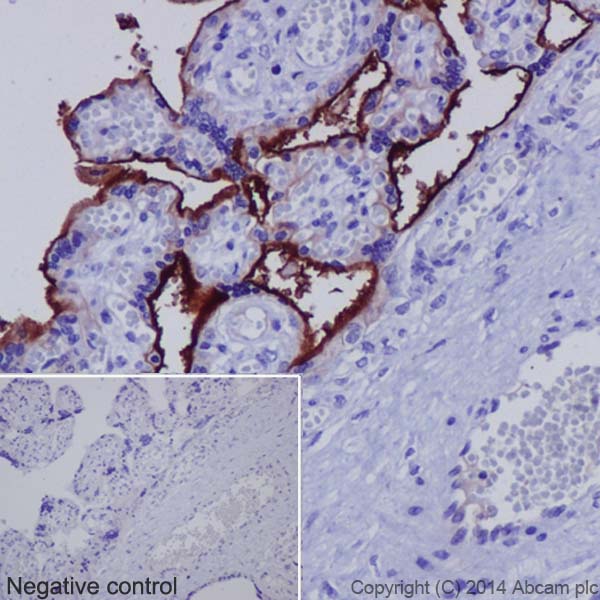 Immunohistochemistry (Formalin/PFA-fixed paraffin-embedded sections) - Anti-5T4 antibody [EPR5529] - BSA and Azide free (AB201711), expandable thumbnail