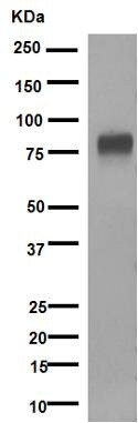 Western blot - Anti-5T4 antibody [EPR5529] - BSA and Azide free (AB201711), expandable thumbnail