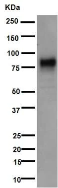 Western blot - Anti-5T4 antibody [EPR5529] - BSA and Azide free (AB201711)