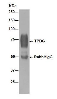Anti-5T4 antibody [EPR5530]