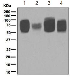 Western blot - Anti-5T4 antibody [EPR5530] (AB129058)