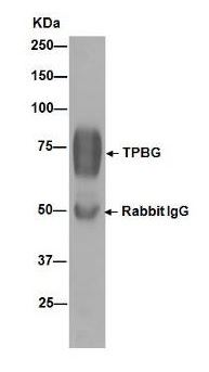 Immunoprecipitation - Anti-5T4 antibody [EPR5530] - BSA and Azide free (AB189508)