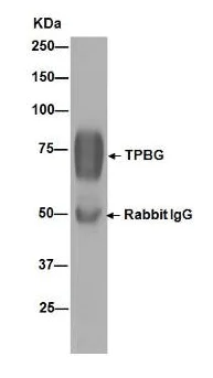 Immunoprecipitation - Anti-5T4 antibody [EPR5530] - BSA and Azide free (AB189508)