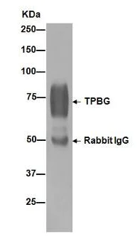 Immunoprecipitation - Anti-5T4 antibody [EPR5530] - BSA and Azide free (AB189508)