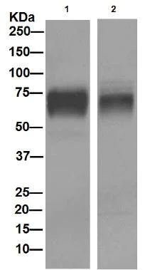Western blot - Anti-5T4 antibody [EPR5530] - BSA and Azide free (AB189508)