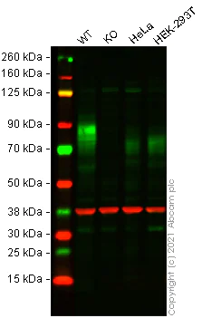 Western blot - Anti-5T4 antibody [EPR5530] - BSA and Azide free (AB189508)