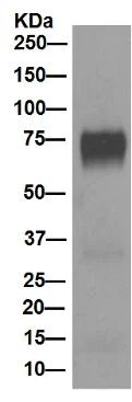 Western blot - Anti-5T4 antibody [EPR5530] - BSA and Azide free (AB189508)
